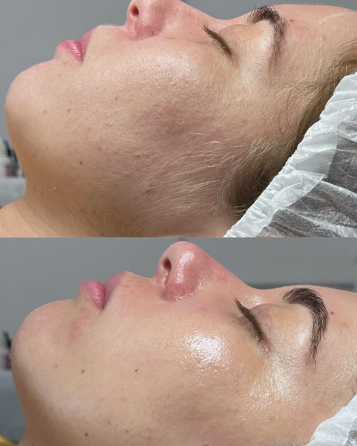 5 choses à savoir sur le duvet (le "peach fuzz")