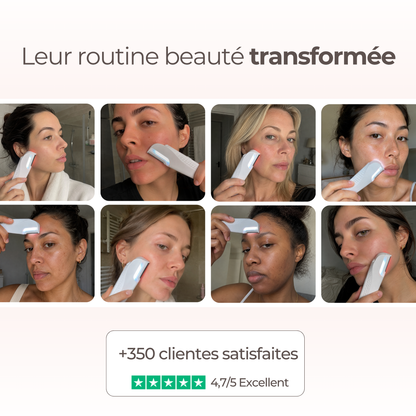 Dermaplaning sonic Dermason Pro avis clients